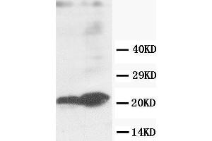 Anti-GST3/GST pi antibody, Western blotting Lane 1: MCF-7 Cell Lysate Lane 2: COLO320 Cell Lysate