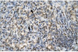 Immunohistochemistry (IHC) image for anti-Early Growth Response 1 (EGR1) (N-Term) antibody (ABIN2779517)