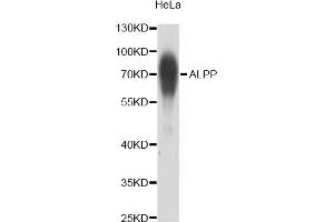 Western blot analysis of extracts of HeLa cells, using ALPP antibody (ABIN2561070) at 1:1000 dilution. (PLAP Antikörper)