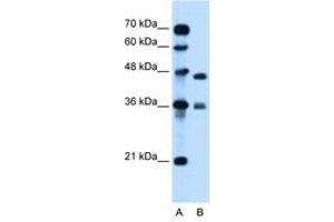Image no. 1 for anti-N-Methylpurine-DNA Glycosylase (MPG) (C-Term) antibody (ABIN6736677)