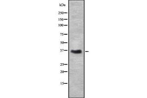 Western blot analysis of DAZL using Jurkat whole cell lysates (DAZL Antikörper  (Internal Region))