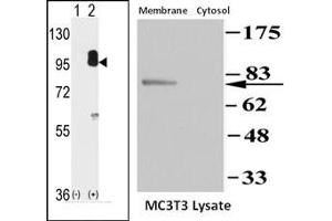 Image no. 1 for anti-Protein Kinase, CGMP-Dependent, Type II (PRKG2) (C-Term) antibody (ABIN360423)