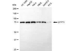 anti-Glutamine--Fructose-6-Phosphate Transaminase 1 (GFPT1) antibody