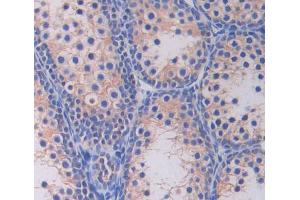 Used in DAB staining on fromalin fixed paraffin- embedded testis tissue (PLIN1 Antikörper  (AA 1-210))