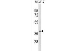 ESR1 isoform4 Antibody (Center) (ABIN1881318 and ABIN2838702) western blot analysis in MCF-7 cell line lysates (35 μg/lane). (Estrogen Receptor alpha Antikörper  (C-Term))