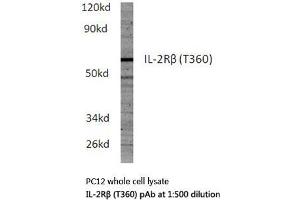 Western blot (WB) analysis of IL-2Rβ antibody in extracts from PC12 cells. (IL2 Receptor beta Antikörper)