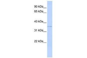HIBADH antibody used at 1 ug/ml to detect target protein. (HIBADH Antikörper  (Middle Region))