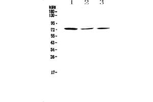 Western blot analysis of TORC2 using anti-TORC2 antibody .
