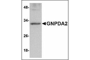 Western blot analysis of GNPDA2 in human kidney lysate with GNPDA2 antibody at 1 µg/ml. (GNPDA2 Antikörper  (C-Term))