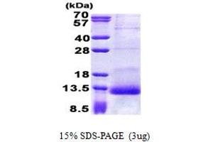 SDS-PAGE (SDS) image for serine Peptidase Inhibitor, Kazal Type 1 (SPINK1) (AA 24-79) protein (His tag) (ABIN5853074)