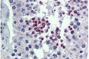 Human Testis: Formalin-Fixed, Paraffin-Embedded (FFPE) (OCT4 Antikörper  (AA 6-152))