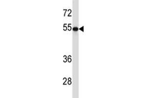 TUBB2A antibody western blot analysis in 293 lysate. (TUBB2A Antikörper  (AA 410-438))