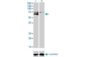 Western blot analysis of ALPL over-expressed 293 cell line, cotransfected with ALPL Validated Chimera RNAi (Lane 2) or non-transfected control (Lane 1). (ALPL Antikörper  (AA 91-200))
