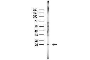 anti-Protein B-Myc (Bmyc) antibody