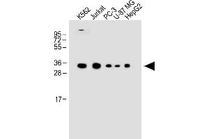 All lanes : Anti-P1R3G Antibody (C-term) at 1:1000 dilution Lane 1: K562 whole cell lysate Lane 2: Jurkat whole cell lysate Lane 3: PC-3 whole cell lysate Lane 4: U-87 MG whole cell lysate Lane 5: HepG2 whole cell lysate Lysates/proteins at 20 μg per lane. (PPP1R3G Antikörper  (C-Term))