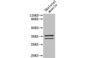 Western Blot Positive WB detected in: Mouse skeletal muscle tissue All lanes: TNNT2 antibody at 4 μg/mL Secondary Goat polyclonal to rabbit IgG at 1/50000 dilution Predicted band size: 36, 35, 32, 31 kDa Observed band size: 36, 32 kDa (Cardiac Troponin T2 Antikörper  (AA 138-298))