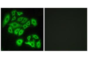 Immunofluorescence analysis of A549 cells, using FZD4 antibody.