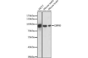 Western blot analysis of extracts of various cell lines, using CBP80 antibody (ABIN6134006, ABIN6138009, ABIN6138010 and ABIN6218117) at 1:1000 dilution. (NCBP1 Antikörper)