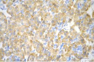 anti-Branched Chain Amino-Acid Transaminase 1, Cytosolic (BCAT1) antibody