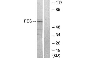 Western Blotting (WB) image for anti-Feline Sarcoma Oncogene (FES) (Internal Region) antibody (ABIN1849116) (FES Antikörper  (Internal Region))