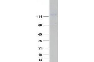 Western Blotting (WB) image for Seizure Related 6 Homolog (SEZ6) (Transcript Variant 1) protein (Myc-DYKDDDDK Tag) (ABIN2731606)