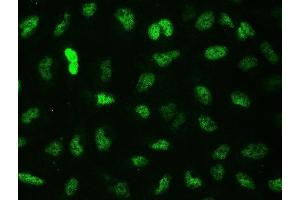 IF analysis of CTBP2 using anti-CTBP2 antibody (ABIN3042768).