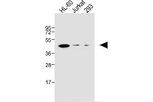 All lanes : Anti-EDG6 Antibody at 1:1000 dilution Lane 1: HL-60 whole cell lysate Lane 2: Jurkat whole cell lysate Lane 3: 293 whole cell lysate Lysates/proteins at 20 μg per lane.