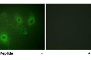 Immunofluorescence analysis of COS-7 cells, using ITPR1 polyclonal antibody . (ITPR1 Antikörper)