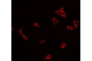 ABIN6269346 staining Hela by IF/ICC. (GRIN2B Antikörper  (C-Term))