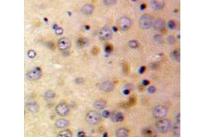 Used in DAB staining on fromalin fixed paraffin-embedded Brain tissue (Afamin Antikörper  (AA 210-403))