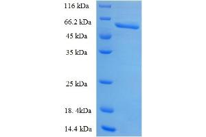 SDS-PAGE (SDS) image for Plasminogen Activator, Urokinase Receptor (PLAUR) (AA 23-305) protein (GST tag) (ABIN5710113)