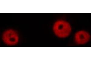 ABIN6269079 staining HeLa by IF/ICC. (Lamin A/C Antikörper  (Internal Region))