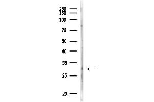 Western blot analysis of lysates from MDA-MB-231 cells(heat-shock,45 min treatment), using LRAT Antibody at 1/1000 dilution.