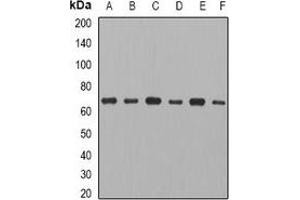 Western blot analysis of CCT3 expression in MCF7 (A), THP1 (B), mouse ovary (C), mouse thymus (D), rat spleen (E), rat heart (F) whole cell lysates. (CCT3 Antikörper)