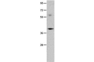 Western Blot analysis of Mouse brain tissue using OPCML Polyclonal Antibody at dilution of 1:400