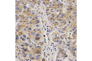 Immunohistochemistry (IHC) image for anti-VAMP (Vesicle-Associated Membrane Protein)-Associated Protein B and C (VAPB) antibody (ABIN1876551) (VAPB Antikörper)