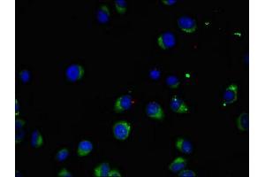 Immunofluorescent analysis of A549 cells using ABIN7169063 at dilution of 1:100 and Alexa Fluor 488-congugated AffiniPure Goat Anti-Rabbit IgG(H+L) (MAK Antikörper  (AA 200-440))