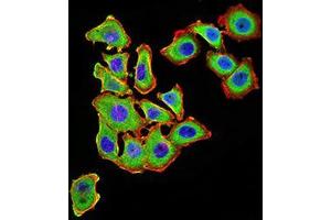Immunocytochemistry (ICC) image for anti-Uncoupling Protein 3 (Mitochondrial, Proton Carrier) (UCP3) (AA 1-113), (AA 217-312) antibody (ABIN5871957) (UCP3 Antikörper  (AA 1-113, AA 217-312))