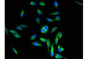 Immunofluorescence (IF) image for anti-Periostin (POSTN) (AA 24-836) antibody (ABIN7162915)
