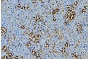 ABIN6272871 at 1/100 staining Mouse kidney tissue by IHC-P. (MKS1 Antikörper)