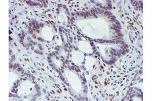 Image no. 5 for anti-WW Domain Containing Transcription Regulator 1 (WWTR1) antibody (ABIN1501763) (WWTR1 Antikörper)