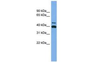 Image no. 1 for anti-Fibrinogen-Like 2 (FGL2) (AA 251-300) antibody (ABIN6744950) (FGL2 Antikörper  (AA 251-300))