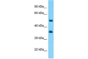 Host:  Rabbit  Target Name:  SERPINB3  Sample Type:  Thymus Tumor lysates  Antibody Dilution:  1. (SERPINB3 Antikörper  (Middle Region))