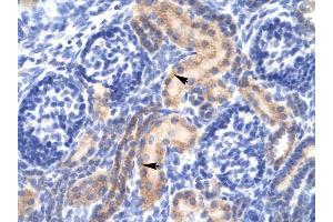 PCK1 antibody was used for immunohistochemistry at a concentration of 4-8 ug/ml to stain Epithelial cells of renal tubule (arrows) in Human Kidney. (PCK1 Antikörper  (Soluble))