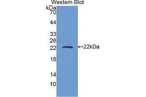 Western blot analysis of the recombinant protein. (FTH1 Antikörper  (AA 1-171))