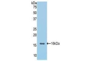 Western Blotting (WB) image for anti-Cadherin 1, Type 1, E-Cadherin (Epithelial) (CDH1) (AA 155-266) antibody (ABIN2901804)