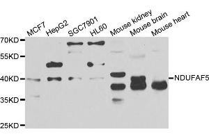 Western blot analysis of extracts of various cell lines, using NDUFAF5 antibody. (C20orf7 Antikörper)