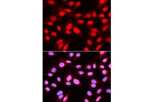 Immunofluorescence analysis of U2OS cells using U2AF2 antibody. (U2AF2 Antikörper)