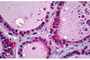 Human Thyroid: Formalin-Fixed, Paraffin-Embedded (FFPE) (SFTPD Antikörper  (AA 21-376))