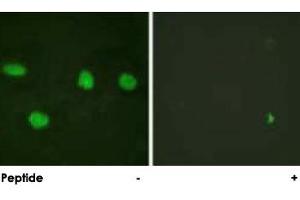 Immunofluorescence analysis of HeLa cells, using TP53BP1 polyclonal antibody . (TP53BP1 Antikörper)